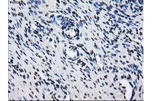 Immunohistochemical staining of paraffin-embedded colon tissue using anti-HDAC10mouse monoclonal antibody. (HDAC10 抗体)