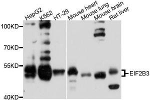 Western blot analysis of extracts of various cell lines, using EIF2B3 antibody.