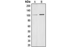 Western blot analysis of CHD1L expression in HeLa (A), HEK293T (B) whole cell lysates. (CHD1L 抗体  (Center))