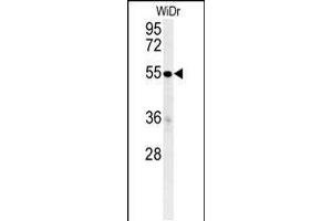 Western blot analysis in WiDr cell line lysates (35ug/lane). (C4BPA 抗体  (C-Term))