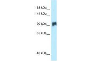 Image no. 1 for anti-Salt-Inducible Kinase 2 (SIK2) (AA 281-330) antibody (ABIN6747898)
