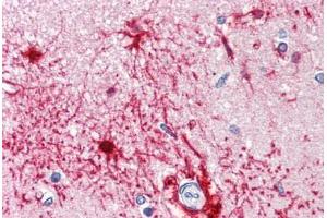 Anti-FABP7 / BLBP antibody IHC staining of human brain, cortex. (FABP7 抗体  (AA 1-132))