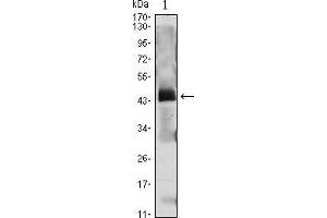 Western blot analysis using PTH mAb against PTH(AA: 1-115)-hIgGFc transfected HEK293 cell lysate. (PTH 抗体  (AA 1-115))