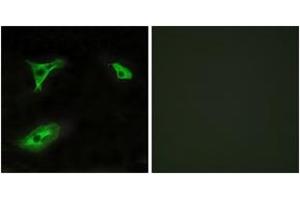 Immunofluorescence analysis of HeLa cells, using GPR116 Antibody.