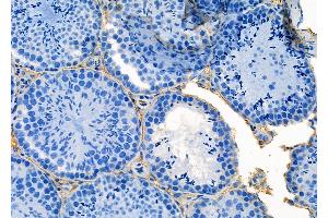 ABIN6264958 and ABIN6273159 at 1/100 staining Mouse testis tissue by IHC-P. (SEC24A 抗体  (Internal Region))