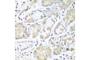 Immunohistochemistry of paraffin-embedded human stomach using RPH3AL antibody at dilution of 1:100 (40x lens). (RPH3AL 抗体)