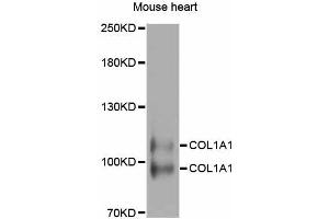 Western blot analysis of extracts of mouse heart, using COL1A1 antibody. (COL1A1 抗体)