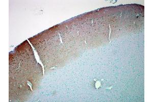 Immunohistochemistry analysis using Mouse Anti-CaMKII Monoclonal Antibody, Clone 6G9 . (CAMKII gamma 抗体  (PE))