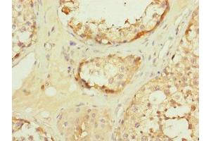 Immunohistochemistry of paraffin-embedded human testis tissue using ABIN7159917 at dilution of 1:100 (TOMM34 抗体  (AA 1-309))