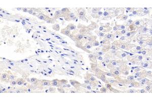 Detection of LTF in Canine Liver Tissue using Polyclonal Antibody to Lactoferrin (LTF) (Lactoferrin 抗体  (AA 28-351))