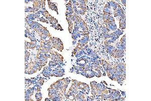 IHC analysis of SUCLG2 using anti-SUCLG2 antibody (ABIN7601694).