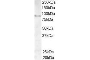 Western Blotting (WB) image for anti-A Kinase (PRKA) Anchor Protein 3 (AKAP3) (C-Term) antibody (ABIN2465380) (AKAP3 抗体  (C-Term))