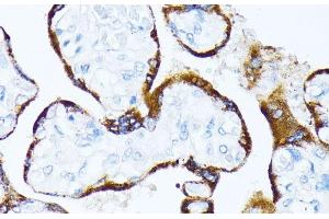 Immunohistochemistry of paraffin-embedded Human placenta using CSNK1A1 Polyclonal Antibody at dilution of 1:100 (40x lens). (CSNK1A1 抗体)
