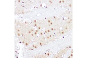 Immunohistochemistry of paraffin-embedded rat brain using SMOX Rabbit pAb (ABIN6132875, ABIN6148142, ABIN6148143 and ABIN6215369) at dilution of 1:100 (40x lens). (SMOX 抗体  (AA 1-200))
