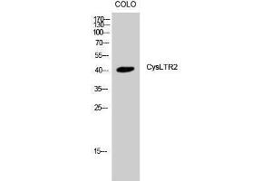 Western Blotting (WB) image for anti-Cysteinyl Leukotriene Receptor 2 (CYSLTR2) (C-Term) antibody (ABIN3184210)