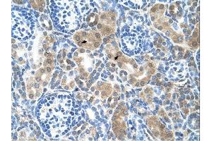 CBS antibody was used for immunohistochemistry at a concentration of 4-8 ug/ml. (CBS 抗体  (N-Term))