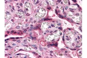 Immunohistochemical analysis of paraffin-embedded human Placenta tissues using CTNNB1 antibody (CTNNB1 抗体)