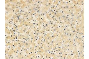 anti-Trafficking Protein Particle Complex 3 (TRAPPC3) (N-Term) antibody