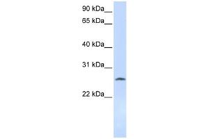 WB Suggested Anti-DCK Antibody Titration: 0. (DCK 抗体  (Middle Region))