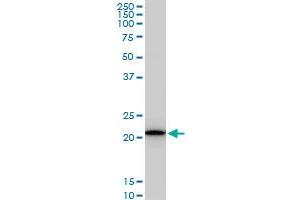 RPS5 monoclonal antibody (M02), clone 4H3. (RPS5 抗体  (AA 106-204))