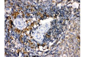 Anti- TGM2 Picoband antibody, IHC(P) IHC(P): Rat Spleen Tissue (Transglutaminase 2 抗体  (N-Term))