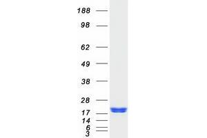 Validation with Western Blot
