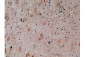 Immunohistochemistry (IHC) image for anti-Polycystic Kidney Disease 1 (Autosomal Dominant) (PKD1) (AA 651-876) antibody (ABIN2119727)