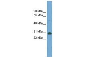 Image no. 1 for anti-TGFB-Induced Factor Homeobox 2-Like, X-Linked (TGIF2LX) (AA 101-150) antibody (ABIN6744629) (TGIF2LX 抗体  (AA 101-150))