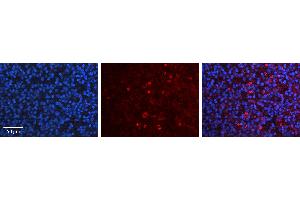Rabbit Anti-USF1 Antibody   Formalin Fixed Paraffin Embedded Tissue: Human Lymph Node Tissue Observed Staining: Nucleus Primary Antibody Concentration: 1:100 Other Working Concentrations: N/A Secondary Antibody: Donkey anti-Rabbit-Cy3 Secondary Antibody Concentration: 1:200 Magnification: 20X Exposure Time: 0. (USF1 抗体  (N-Term))