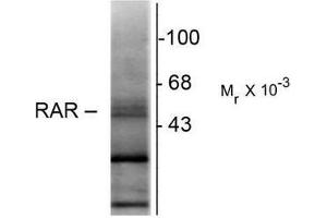 Western Blotting (WB) image for anti-Retinoic Acid Receptor, beta (RARB) (N-Term) antibody (ABIN371838) (Retinoic Acid Receptor beta 抗体  (N-Term))