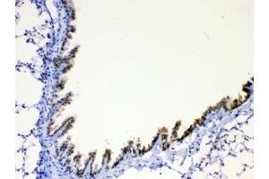 IHC testing of FFPE mouse lung tissue with AGRP antibody at 1ug/ml.