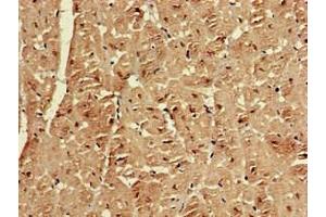 Immunohistochemistry of paraffin-embedded human heart tissue using ABIN7151606 at dilution of 1:100 (Emerin 抗体  (AA 1-222))