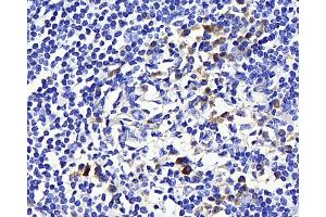 Immunohistochemistry analysis of paraffin-embedded human tonsil using CD169 Polyclonal Antibody at dilution of 1:300. (Sialoadhesin/CD169 抗体)
