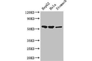 Western Blot Positive WB detected in: HepG2 whole cell lysate, Hela whole cell lysate, Mouse stomach tissue All lanes: SLC37A2 antibody at 3 μg/mL Secondary Goat polyclonal to rabbit IgG at 1/50000 dilution Predicted band size: 55, 43, 14 kDa Observed band size: 55 kDa (SLC37A2 抗体  (AA 46-84))
