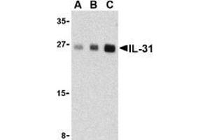 Western blot analysis of IL-31 in human skeletal muscle tissue lysate with AP30423PU-N IL-31 antibody at (A) 2. (IL-31 抗体  (Intermediate Domain))