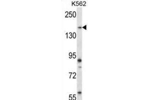 Western Blotting (WB) image for anti-Pseudopodium-Enriched Atypical Kinase 1 (PEAK1) antibody (ABIN2998316) (PEAK1 抗体)