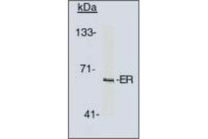 Image no. 1 for anti-Estrogen Receptor 1 (ESR1) antibody (ABIN201714) (Estrogen Receptor alpha 抗体)