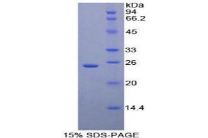 SDS-PAGE analysis of Human Iga Protein. (CD79a 蛋白)