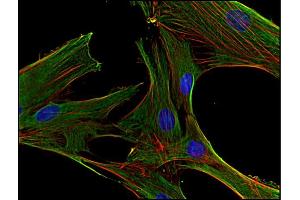 Immunocytochemistry (ICC) image for anti-Clathrin Heavy Chain (CLTC) antibody (ABIN302098)