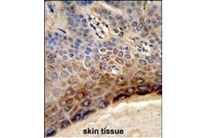 Immunohistochemistry (Paraffin-embedded Sections) (IHC (p)) image for anti-Collagen Triple Helix Repeat Containing 1 (CTHRC1) (AA 19-46), (N-Term) antibody (ABIN652724)