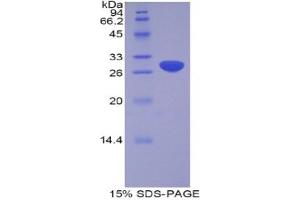 SDS-PAGE analysis of Human ADAM20 Protein. (ADAM20 蛋白)