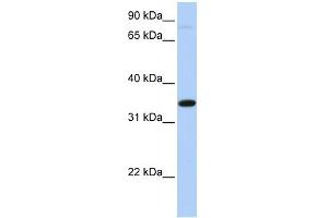 SLC44A3 antibody used at 1 ug/ml to detect target protein. (SLC44A3 抗体  (Middle Region))