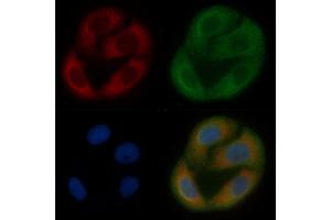 ALDH3B2 Mouse Monoclonal Antibody staining Hela cells by IF/ICC. (ALDH3B2 抗体  (C-Term))