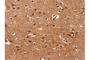 The image on the left is immunohistochemistry of paraffin-embedded Human brain tissue using ABIN7128511(ARL4A Antibody) at dilution 1/50, on the right is treated with fusion protein. (ARL4A 抗体)