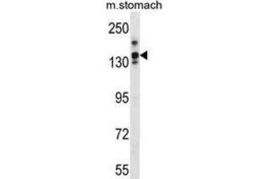 Western Blotting (WB) image for anti-Leucine Rich Repeat Containing 16A (LRRC16A) antibody (ABIN3000050) (LRRC16A 抗体)