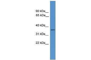 WB Suggested Anti-HNMT Antibody Titration: 0. (HNMT 抗体  (N-Term))