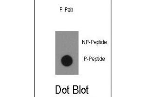 Dot Blot (DB) image for anti-C-Abl Oncogene 1, Non-Receptor tyrosine Kinase (ABL1) (pTyr134) antibody (ABIN3001743) (ABL1 抗体  (pTyr134))
