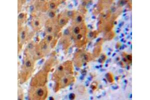 Used in DAB staining on fromalin fixed paraffin-embedded Liver tissue (IL16 抗体  (AA 1203-1322))