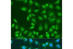 Immunofluorescence analysis of U2OS cells using PLCD4 Polyclonal Antibody at dilution of 1:100. (PLCD4 抗体)