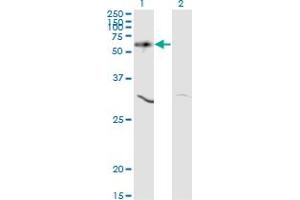 Western Blotting (WB) image for anti-V-Akt Murine Thymoma Viral Oncogene Homolog 1 (AKT1) (AA 1-480) antibody (ABIN559829)